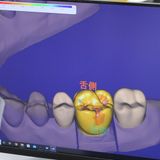 歯科技工士学科　「簡単な体験実習・最新の歯科医療を知る」　の詳細