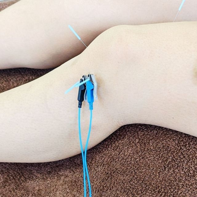 福島医療専門学校 【鍼灸】筋肉の痛みをとる鍼通電療2