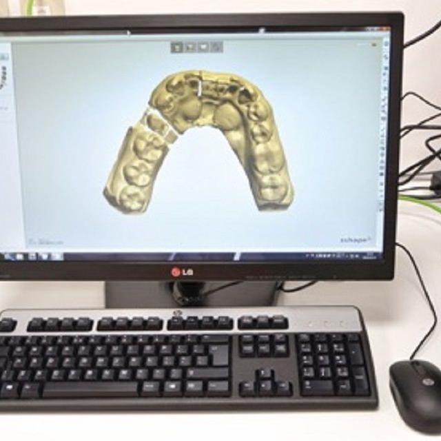 新東京歯科技工士学校 デジタル技工コース体験1
