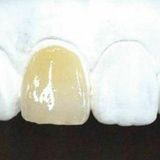 歯科技工士の技がわかる！【白い歯作り体験】の詳細